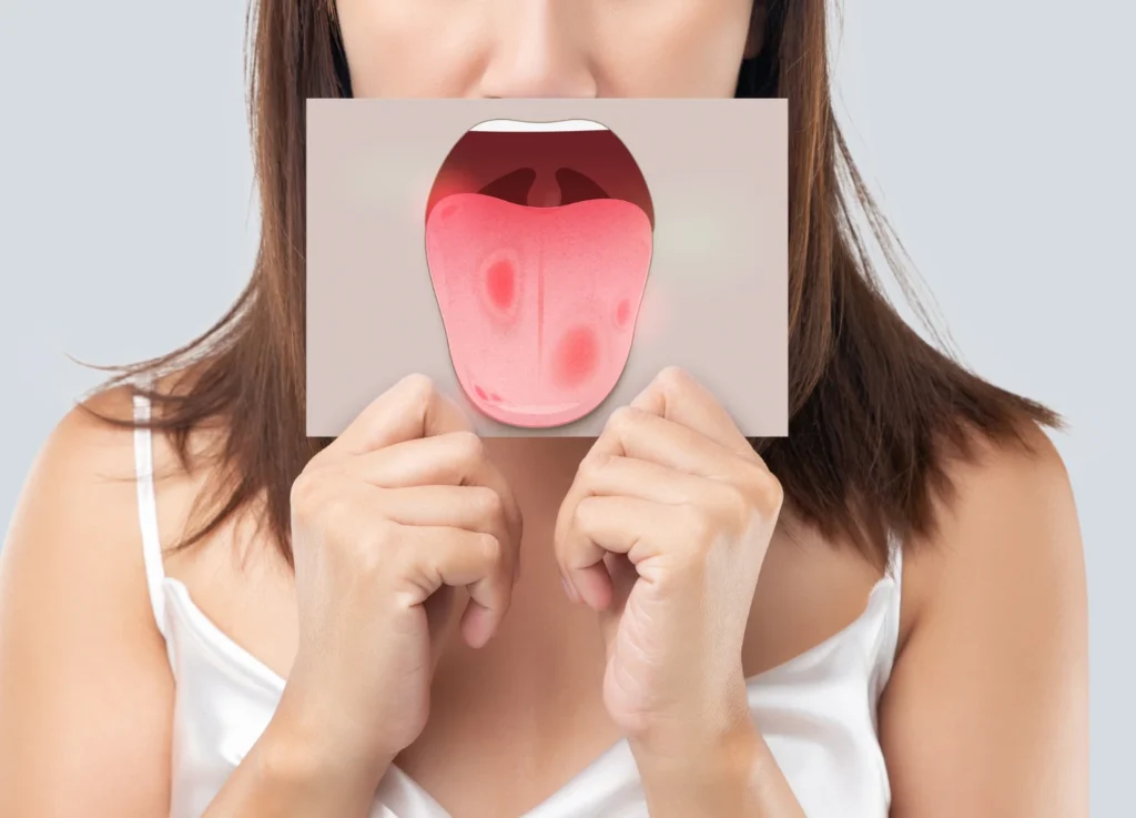 Oral Cancer Screenings